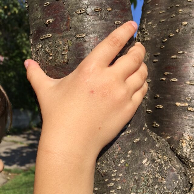 hand on apple tree back
